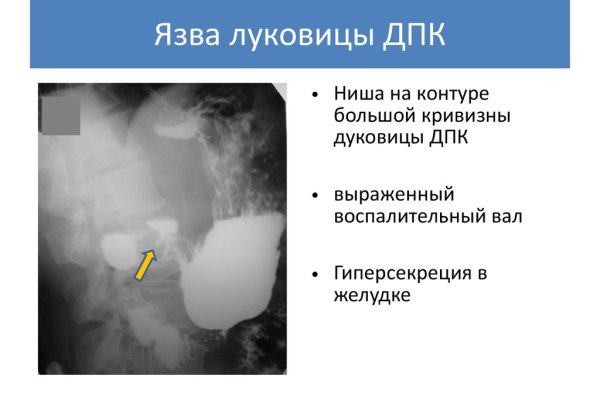 Как найти kraken